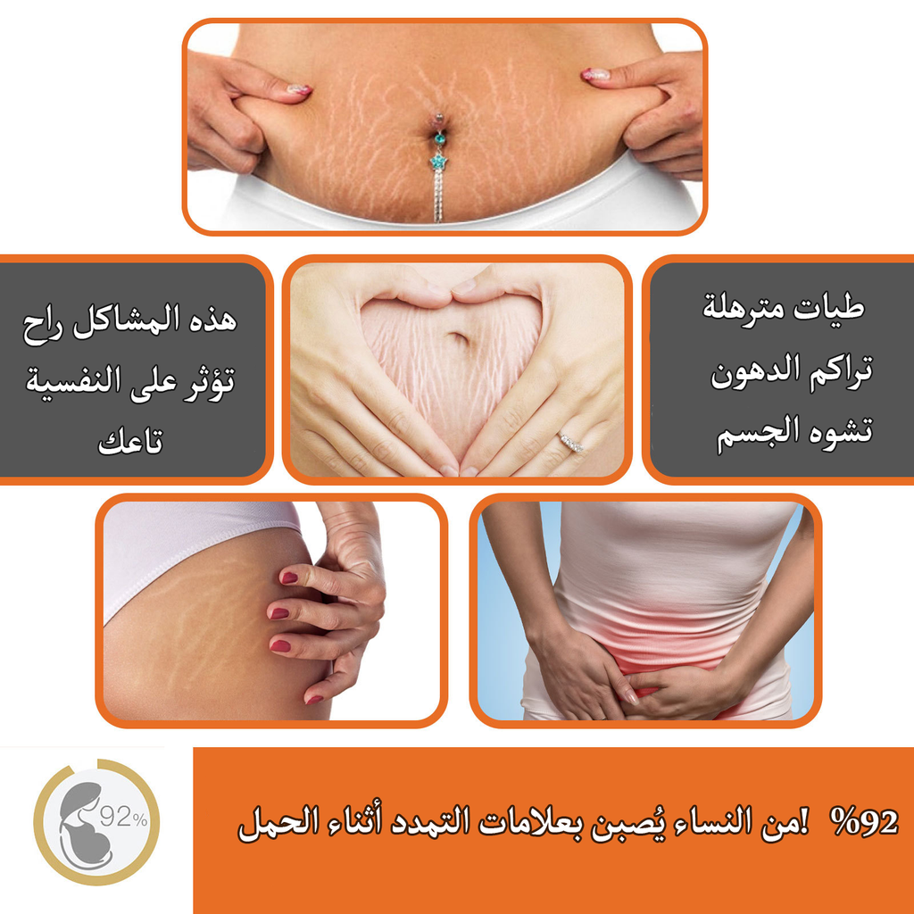 المنتج الكوري الأصلي لعلاج التمددات و الندبات الجلدية EELHOE