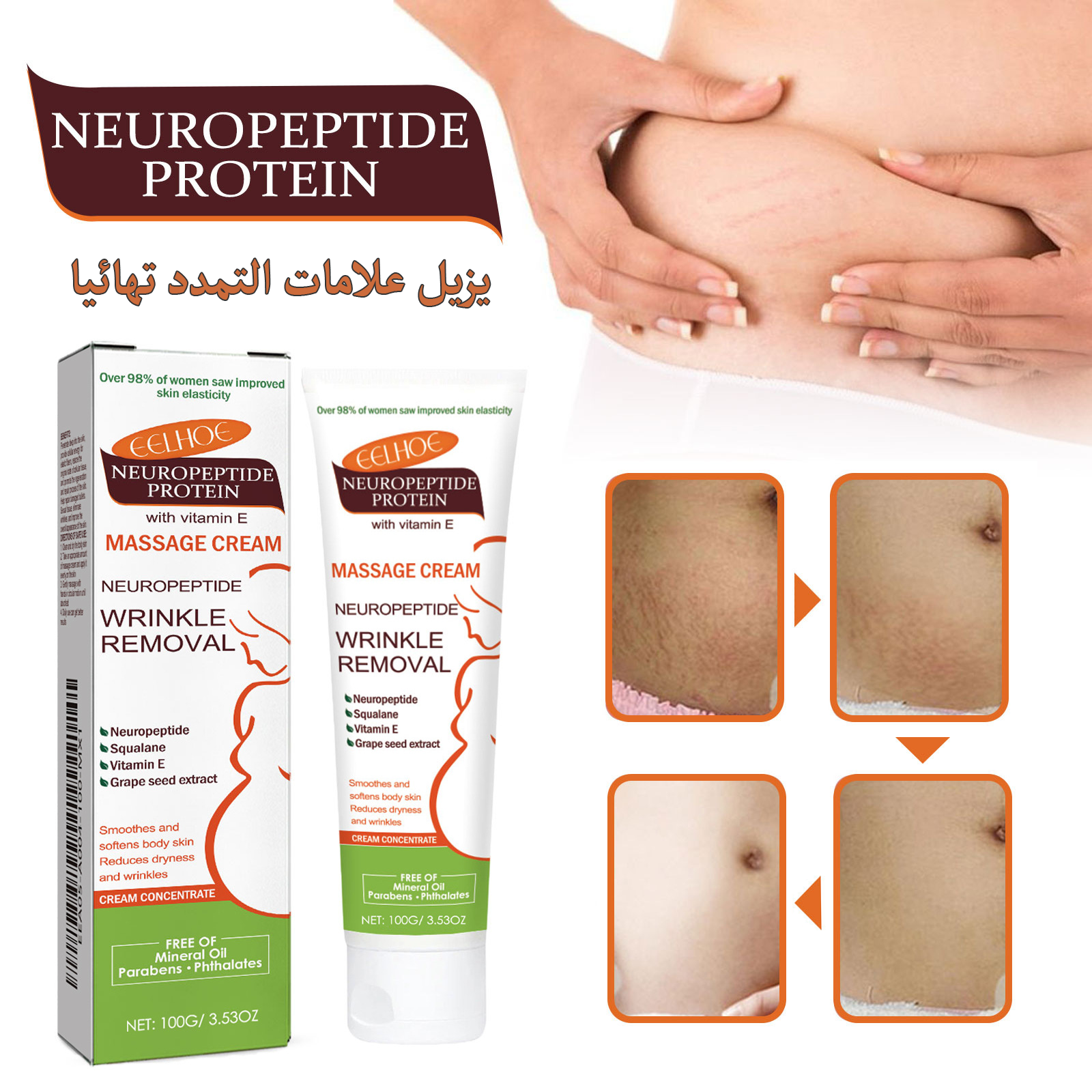 المنتج الكوري الأصلي لعلاج التمددات و الندبات الجلدية EELHOE